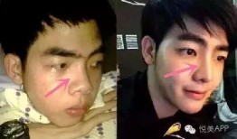 男网红整容脸吃瓜,吃瓜群众围观“变脸”奇观