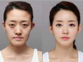 男网红整容脸吃瓜,吃瓜群众围观“变脸”奇观