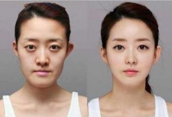 男网红整容脸吃瓜,吃瓜群众围观“变脸”奇观